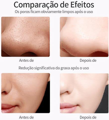 Espátula Facial Ultrassônica - In Highs